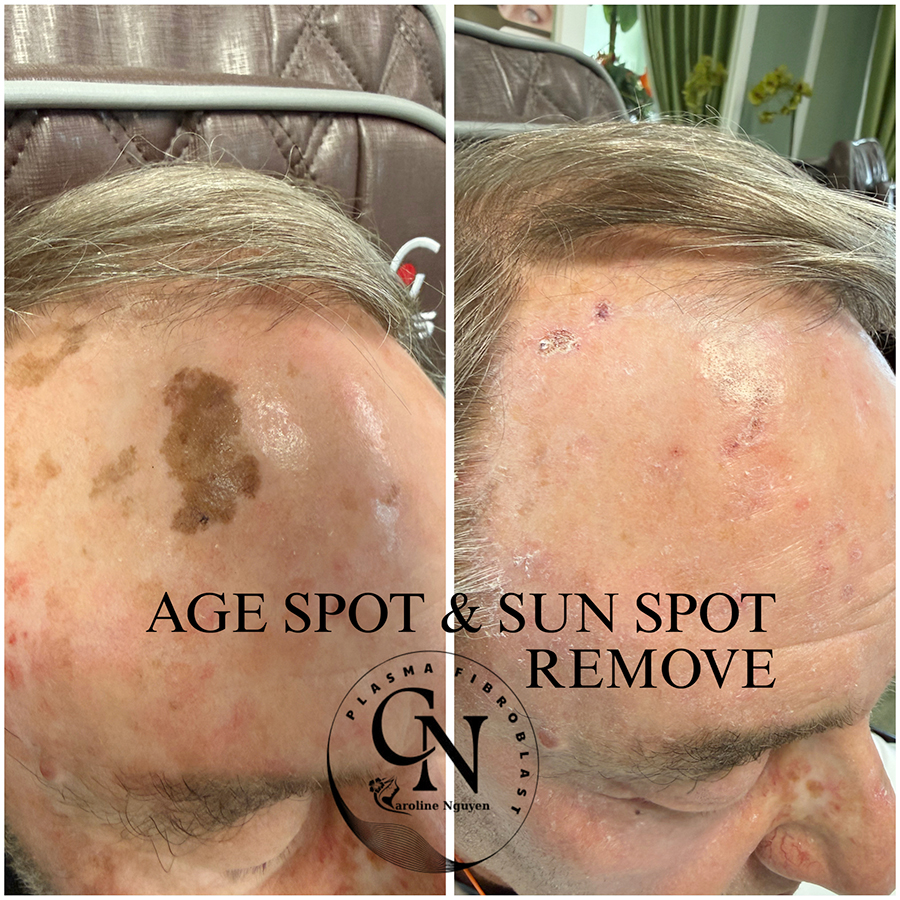 Beauty Transformation